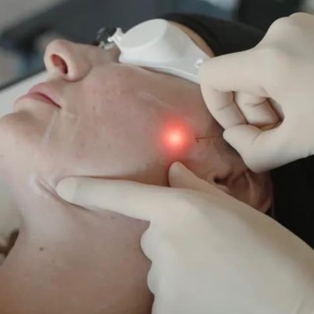 Premium Endolifting Package at Zen Touch in Queens, NY