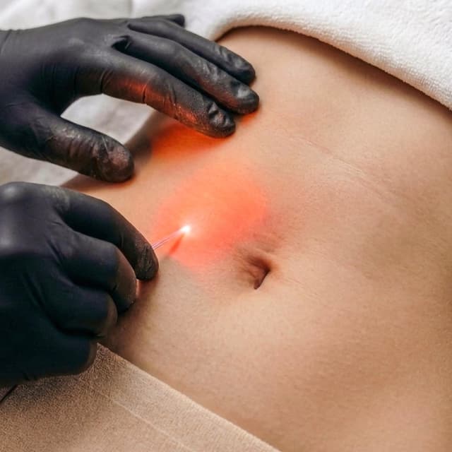 Endolifting VIP Experience at Zen Touch in Queens, NY